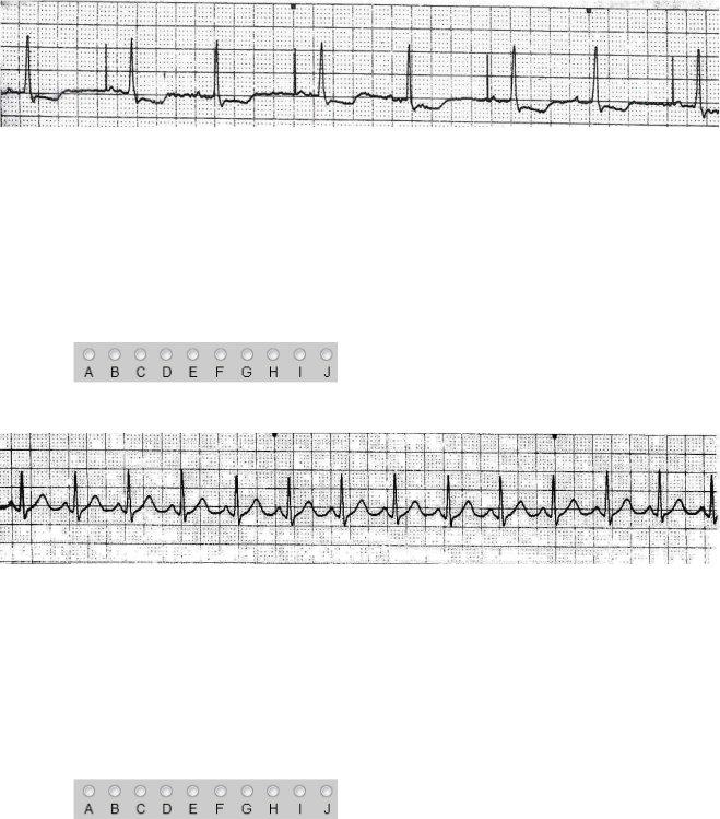 Ekg Practice Form ≡ Fill Out Printable PDF Forms Online