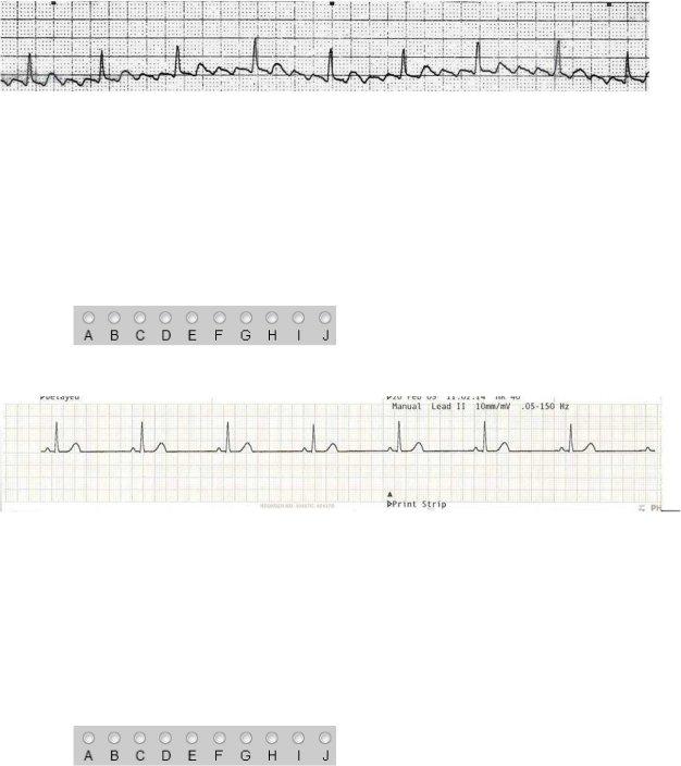 Ekg Practice Form ≡ Fill Out Printable Pdf Forms Online