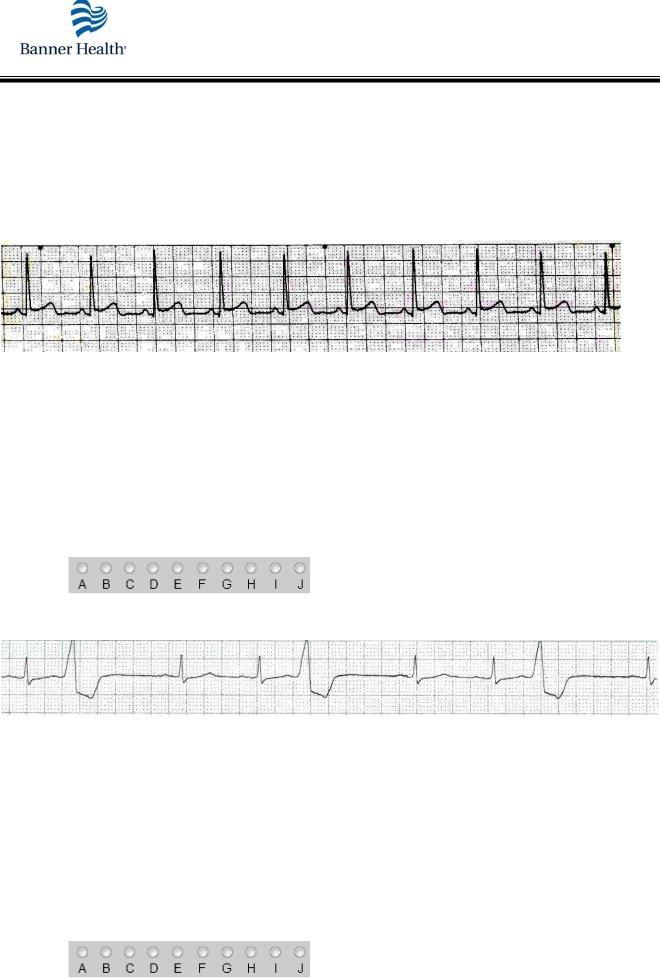 Ekg Practice Form ≡ Fill Out Printable PDF Forms Online