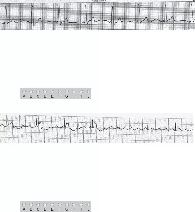 Ekg Practice Form ≡ Fill Out Printable PDF Forms Online