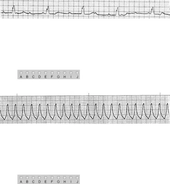 Ekg Practice Form ≡ Fill Out Printable PDF Forms Online