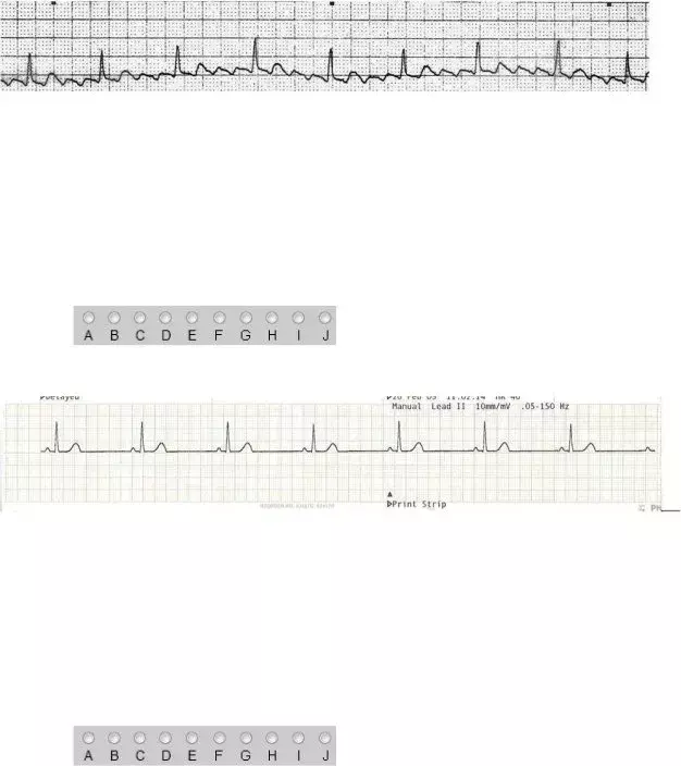 Ekg Practice Form ≡ Fill Out Printable PDF Forms Online