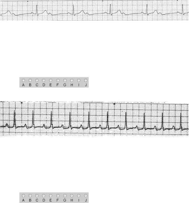 Ekg Practice Form ≡ Fill Out Printable PDF Forms Online