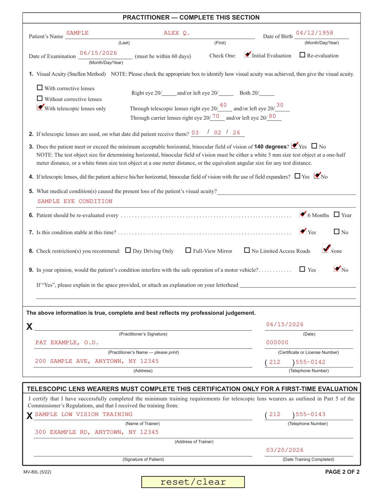 Form MV-80L example filled out, example: a first-time telescopic lens wearer
